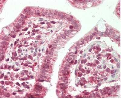 Immunohistochemistry-Paraffin: ZFX Antibody [NBP2-86421] - Human Small Intestine: Formalin-Fixed, Paraffin-Embedded (FFPE).. Antibody Concentration: 10 ug/ml.