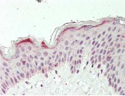 Immunohistochemistry-Paraffin: ZFX Antibody [NBP2-86421] - Human Skin: Formalin-Fixed, Paraffin-Embedded (FFPE).. Antibody Concentration: 10 ug/ml.