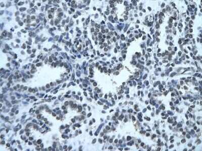 Immunohistochemistry-Paraffin: ZFX Antibody [NBP2-86421] - Rabbit Anti-ZFX Antibody. Paraffin Embedded Tissue: Human alveolar cell. Cellular Data: Epithelial cells of renal tubule. Antibody Concentration: 4.0-8.0 ug/ml. Magnification: 400X