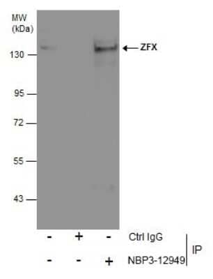 Immunoprecipitation: ZFX Antibody [NBP3-12949] - Immunoprecipitation of ZFX protein from SKNSH whole cell extracts using 5 ug of ZFX antibody (NBP3-12949). Western blot analysis was performed using ZFX antibody (NBP3-12949) diluted at 1:500. EasyBlot anti-Rabbit IgG was used as a secondary reagent.