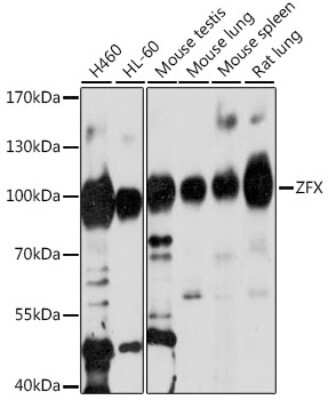 Western Blot: ZFX Antibody [NBP2-95185] - Analysis of extracts of various cell lines, using ZFX . Exposure time: 90s.