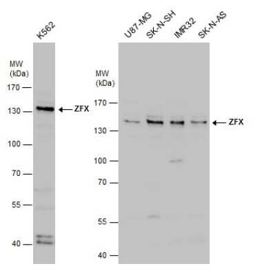 Western Blot: ZFX Antibody [NBP3-12949] - ZFX antibody detects ZFX protein by western blot analysis. Various whole cell extracts (30 ug) were separated by 7.5% SDS-PAGE, and the membrane was blotted with ZFX antibody (NBP3-12949) diluted at 1:1000.