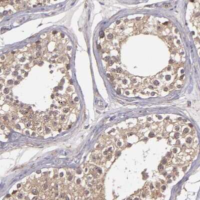 Immunohistochemistry-Paraffin: ZFYVE1 Antibody [NBP1-84267] - Staining of human testis shows moderate positivity in cytoplasm granular in cells in seminiferous ducts.