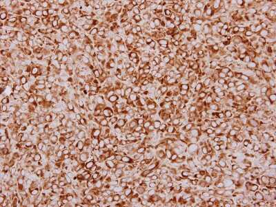 Immunohistochemistry-Paraffin: ZFYVE1 Antibody [NBP2-20950] - Immunohistochemical analysis of paraffin-embedded HS578T xenograft, using antibody at 1:250 dilution.