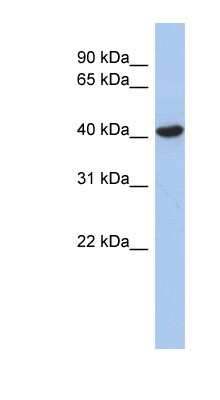 Western Blot ZFYVE1 Antibody