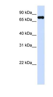 Western Blot: ZFYVE1 Antibody [NBP1-79427] - 293T cells lysate, concentration 0.2-1 ug/ml.