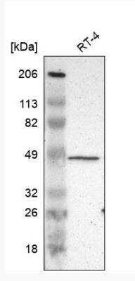 Western Blot: ZFYVE1 Antibody [NBP1-84267] - Analysis in human cell line RT-4.