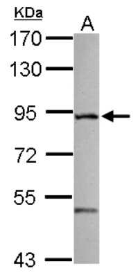 Western Blot ZFYVE1 Antibody