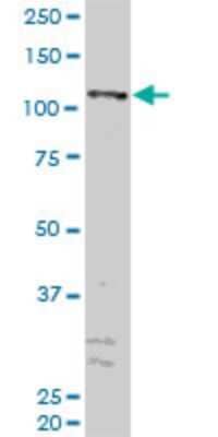 Western Blot: ZFYVE16 Antibody (2E2) [H00009765-M04] - Analysis of ZFYVE16 expression in HepG2 (Cat # L019V1).