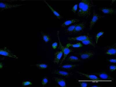 Immunocytochemistry/Immunofluorescence: ZFYVE16 Antibody [H00009765-B01P] - Analysis of purified antibody to ZFYVE16 on HeLa cell. (antibody concentration 10 ug/ml)