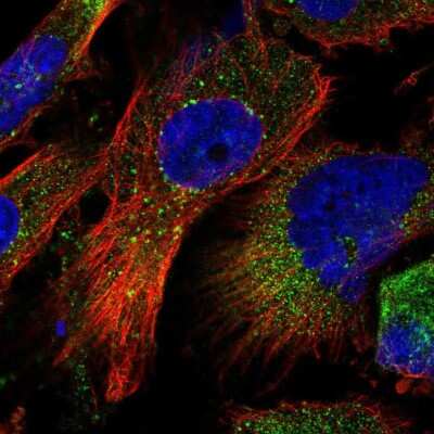 Immunocytochemistry/Immunofluorescence: ZFYVE16 Antibody [NBP1-81517] - Staining of human cell line U-251 MG shows localization to cytosol & vesicles.