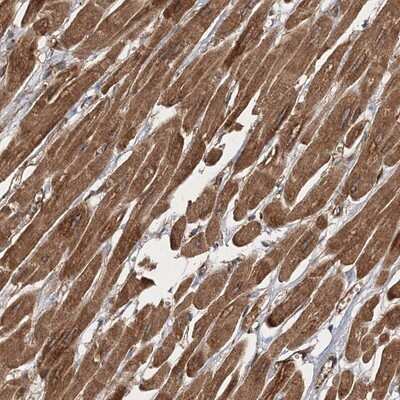 Immunohistochemistry-Paraffin: ZFYVE16 Antibody [NBP1-81517] - Staining of human heart muscle shows moderate cytoplasmic positivity in myocytes.