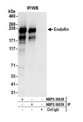 <b>Independent Antibodies Validation and Biological Strategies Validation.</b>Immunoprecipitation: ZFYVE16 Antibody [NBP2-36538] - Detection of human Endofin by western blot of immunoprecipitates. Samples: Whole cell lysate (0.5 or 1.0 mg per IP reaction; 20% of IP loaded) from 293T cells prepared using NETN lysis buffer. Antibodies: Affinity purified rabbit anti-Endofin antibody NBP2-36538) used for IP at 6 ug per reaction. Endofin was also immunoprecipitated by rabbit anti-Endofin antibody NBP2-36539. For blotting immunoprecipitated Endofin, NBP2-36538 was used at 0.4 ug/ml. Detection: Chemiluminescence with an exposure time of 3 seconds.