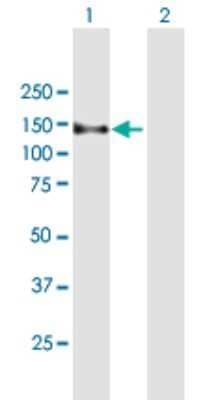 Western Blot: ZFYVE16 Antibody [H00009765-B01P] - Analysis of ZFYVE16 expression in transfected 293T cell line by ZFYVE16 polyclonal antibody.  Lane 1: ZFYVE16 transfected lysate(88.99 KDa). Lane 2: Non-transfected lysate.