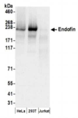 Western Blot: ZFYVE16 Antibody [NBP2-36538] - Samples: Whole cell lysate (50 ug) from HeLa, 293T, and Jurkat cells prepared using NETN lysis buffer. Antibodies: Affinity purified rabbit anti-Endofin antibody used for WB at 0.1 ug/ml. Detection: Chemiluminescence with an exposure time of 3 seconds.