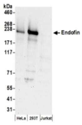 Western Blot: ZFYVE16 Antibody [NBP2-36539] - Samples: Whole cell lysate (50 ug) from HeLa, 293T, and Jurkat cells prepared using NETN lysis buffer. Antibodies: Affinity purified rabbit anti-Endofin antibody used for WB at 0.1 ug/ml. Detection: Chemiluminescence with an exposure time of 30 seconds.