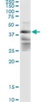 Immunoprecipitation ZFYVE19 Antibody (3G4-2B11) - Azide and BSA Free