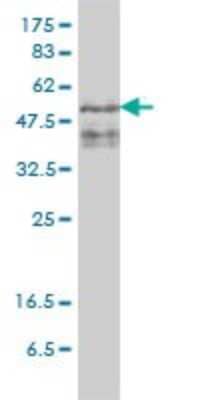 Western Blot: ZFYVE19 Antibody (4D5-2D11) [H00084936-M01] - ZFYVE19 monoclonal antibody (M01), clone 4D5-2D11 Analysis of ZFYVE19 expression in PLC/PRF/5.