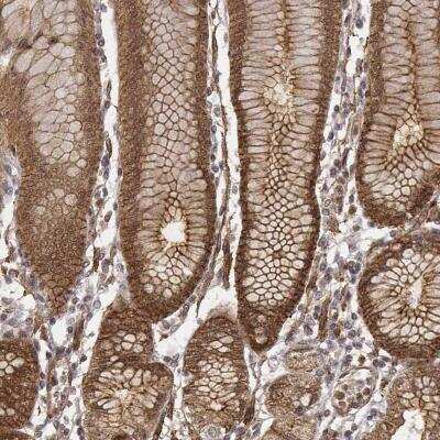 Immunohistochemistry ZFYVE19 Antibody - BSA Free