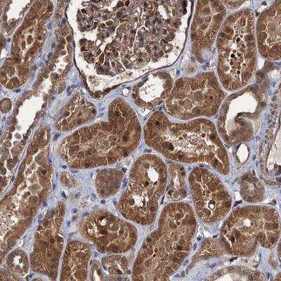 Immunohistochemistry-Paraffin: ZFYVE19 Antibody [NBP1-83679] - Staining of human kidney shows moderate cytoplasmic and nuclear positivity in tubule cells.
