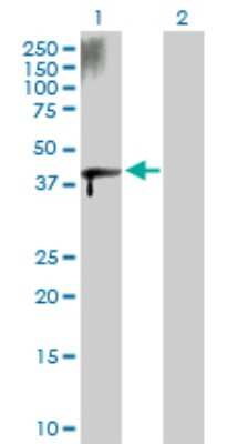 Western Blot: ZFYVE19 Antibody [H00084936-D01P] - Analysis of ZFYVE19 expression in transfected 293T cell line by ZFYVE19 polyclonal antibody.Lane 1: ZFYVE19 transfected lysate(36.40 KDa).Lane 2: Non-transfected lysate.