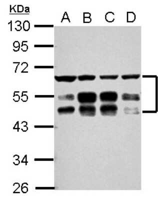 Western Blot: ZFYVE19 Antibody [NBP2-20951] - Sample (30 ug of whole cell lysate) A: 293T B: A431 C: HeLa D: HepG2 10% SDS PAGE gel, diluted at 1:3000.