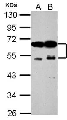 Western Blot: ZFYVE19 Antibody [NBP2-20951] - Sample (30 ug of whole cell lysate) A: NIH-3T3 B: BCL-1 10% SDS PAGE gel, diluted at 1:3000.