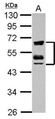 Western Blot: ZFYVE19 Antibody [NBP2-20952] - Sample (30 ug of whole cell lysate) A: K562 10% SDS PAGE gel, diluted at 1:1000.