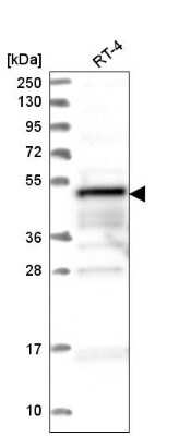 Western Blot ZFYVE19 Antibody - BSA Free
