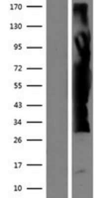 Western Blot ZFYVE19 Overexpression Lysate