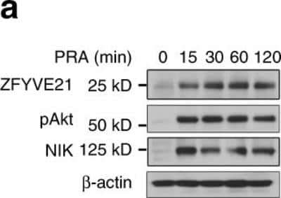 Western Blot: ZFYVE21 Antibody [H00079038-B01P] - Membrane attack complex-induced and endosome-dependent stabilization of ZFYVE21. Human umbilical vein endothelial cells (HUVECs) were treated with panel reactive antibody (PRA) sera (25% v/v in gelatin veronal buffer) (a). HUVECs were treated with MG132 (25uM). Image collected and cropped by CiteAb from the following publication (nature.com/articles/s41467-019-10041-2), licensed under a CC-BY license.