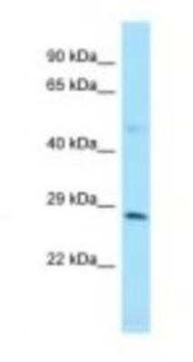 Western Blot: ZFYVE21 Antibody [NBP1-98434] - HCT15 Cell Lysate 1.0 ug/ml, Gel Concentration: 12%