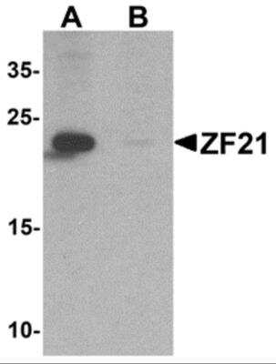 Western Blot: ZFYVE21 Antibody [NBP2-82050] - Western blot analysis of ZFYVE21 in 3T3 cell tissue lysate with ZFYVE21 antibody at 1 ug/ml in (A) the absence and (B) the presence of blocking peptide.