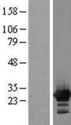 Western Blot: ZFYVE21 Overexpression Lysate (Adult Normal) [NBL1-18027] Left-Empty vector transfected control cell lysate (HEK293 cell lysate); Right -Over-expression Lysate for ZFYVE21.