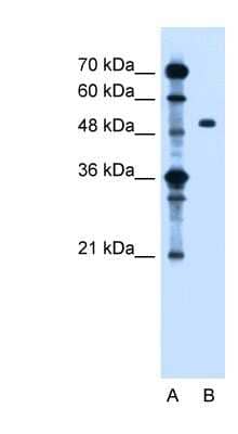 Western Blot: ZFYVE27 Antibody [NBP1-59420] - Jurkat cell lysate, concentration 1.25ug/ml.