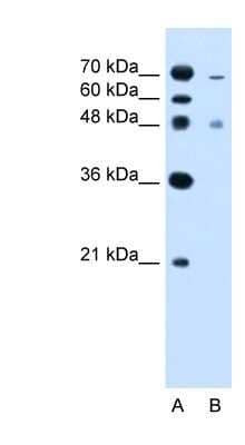 Western Blot: ZFYVE27 Antibody [NBP1-59421] - Jurkat cell lysate, concentration 2.5 ug/ml.