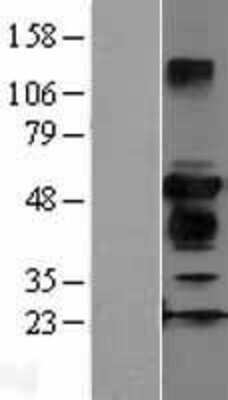 Western Blot ZFYVE27 Overexpression Lysate