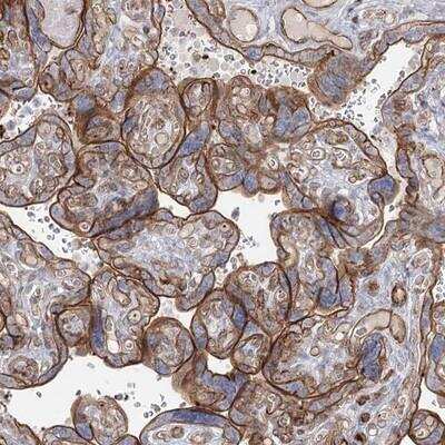 Immunohistochemistry-Paraffin: ZFYVE28 Antibody [NBP1-81390] - Staining of human placenta shows moderate membranous positivity in trophoblastic cells.
