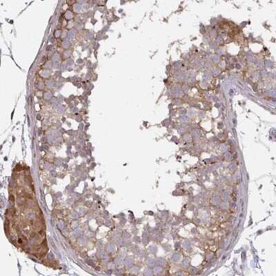 Immunohistochemistry-Paraffin ZFYVE28 Antibody - BSA Free