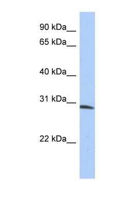 Western Blot: ZFYVE28 Antibody [NBP1-79390] - Human Placenta lysate, concentration 0.2-1 ug/ml.