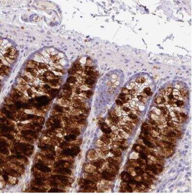 Immunohistochemistry-Paraffin: ZG16 Antibody [NBP2-30568] - Staining of human colon shows strong cytoplasmic positivity in glandular cells.