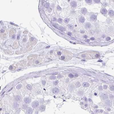 Immunohistochemistry-Paraffin: ZG16 Antibody [NBP2-30488] - Staining of human testis.
