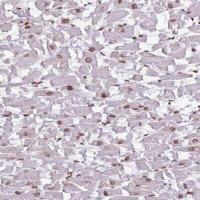 Immunohistochemistry-Paraffin: ZGLP1 Antibody [NBP2-13548] - Staining of human heart muscle shows moderate nuclear membrane positivity in myocytes.