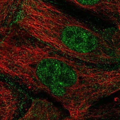 Immunocytochemistry/Immunofluorescence: ZGPAT Antibody [NBP2-55609] - Staining of human cell line CACO-2 shows localization to nucleus & plasma membrane.