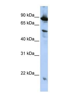 Western Blot: ZGPAT Antibody [NBP1-56561] - HepG2 cell lysate, concentration 0.2-1 ug/ml.