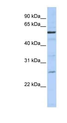 Western Blot: ZGPAT Antibody [NBP1-56562] - 721_B cell lysate, concentration 0.2-1 ug/ml.