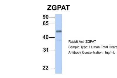 Western Blot: ZGPAT Antibody [NBP1-56562] - Human Fetal Heart, Antibody Dilution: 1.0 ug/ml.