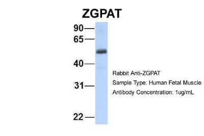 Western Blot: ZGPAT Antibody [NBP1-56562] - Human Fetal Muscle, Antibody Dilution: 1.0 ug/ml.