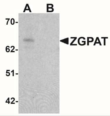 Western Blot: ZGPAT Antibody [NBP2-41146] - Western blot analysis of ZGPAT in SK-N-SH cell lysate with ZGPAT antibody at 1 ug/mL in (A) the absence and (B) the presence of blocking peptide.