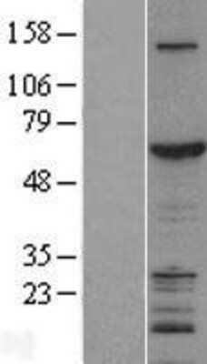 Western Blot: ZGPAT Overexpression Lysate (Adult Normal) [NBL1-18031] Left-Empty vector transfected control cell lysate (HEK293 cell lysate); Right -Over-expression Lysate for ZGPAT.